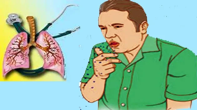 सुदूरपश्चिममा क्षयरोग प्रयोगशालाको स्तरोन्नति